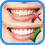 How to Whiten Teeth at home icon