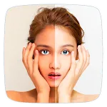 Skin Whitening Home Remedies