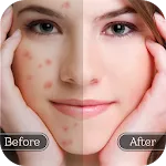 Face Blemish Remover - Smooth icon
