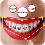 Real Braces Camera icon