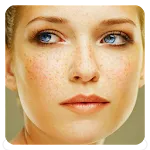 Freckles Tips icon